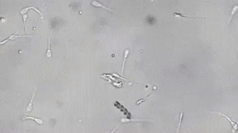 Spermbot: nano robot - Herketsiz sperm robotu https://huglero.com